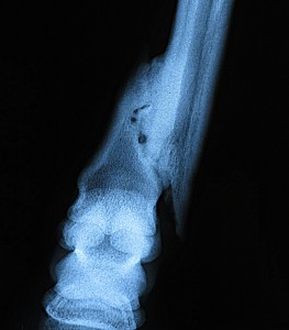 Missy's healed fracture 3